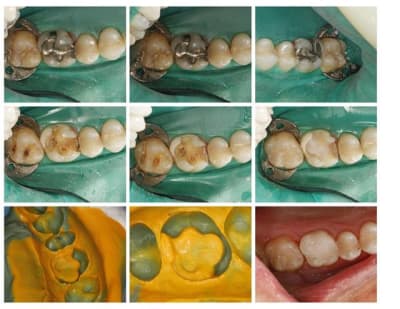 C goulet prep 16  custom  kb8d6s - Eugenol