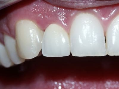 Ccc12avecflash tzqloa - Eugenol