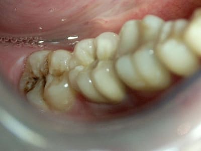 Ccmorsansflash nh894z - Eugenol