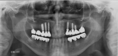 Chat mo 05.01 - Eugenol