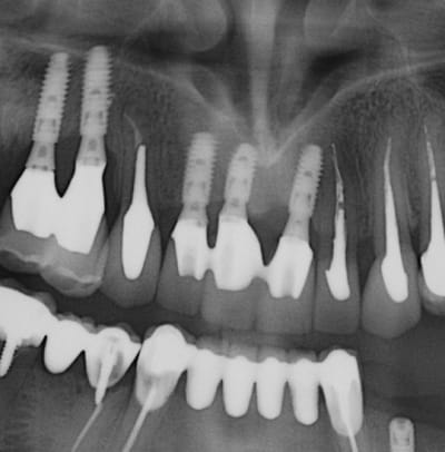 Cha mi 13.02 - Eugenol