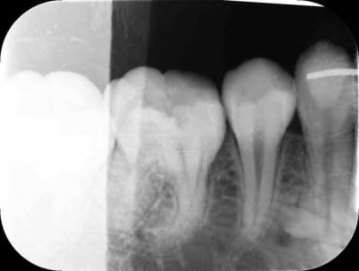 Ci1 lbpxhl - Eugenol