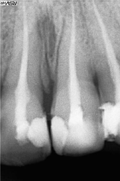 Cmu3 unegma - Eugenol