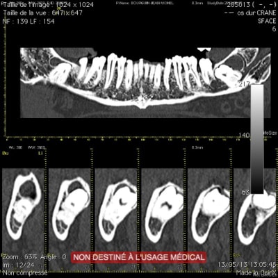 Ct4 ekv8ss - Eugenol
