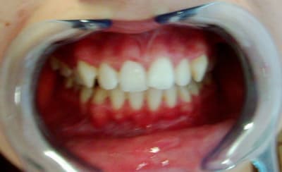 C dsci0017 zi4ws9 - Eugenol