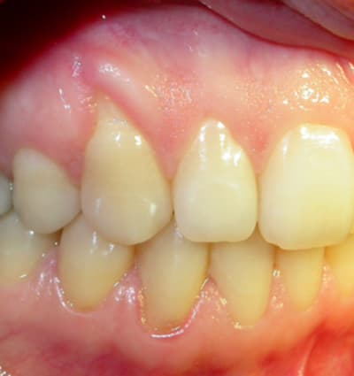 C costelcade ybert3 rvad1v - Eugenol
