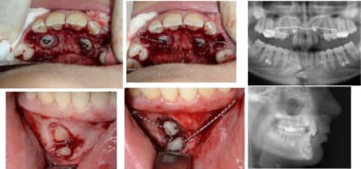 Canine 1 lvpmga - Eugenol