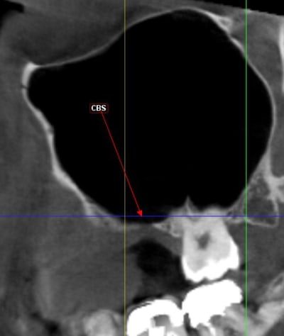 Capt 1949039 yc99fq - Eugenol