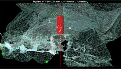 Capture1 bzketg - Eugenol