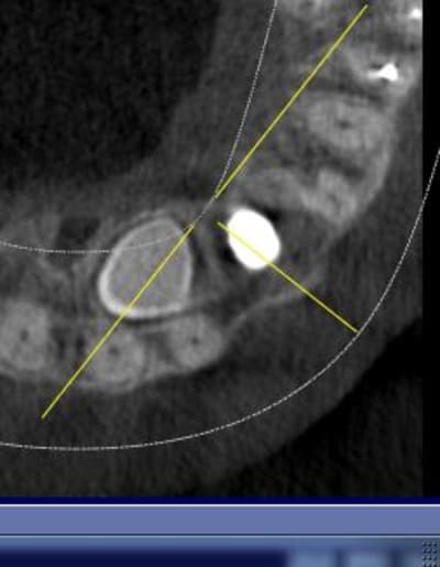Capture1 hthjjo - Eugenol