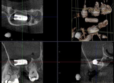 Capture1 trrllw - Eugenol