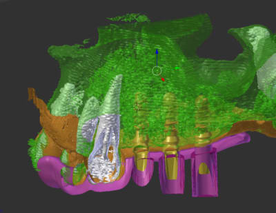 Capture2 os3kxi - Eugenol