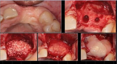 Capture 1 ub2xxy - Eugenol
