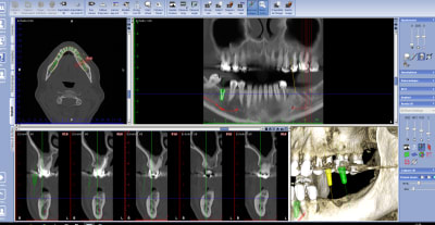 Capture 5 li2vc6 - Eugenol