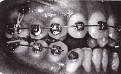 Capture d  cran 2013 05 01   21.33 - Eugenol