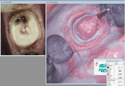 Capture d écran 2017 03 22 14.51 - Eugenol