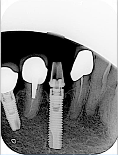 Capture d e cran 2014 09 19 a  09.07 - Eugenol