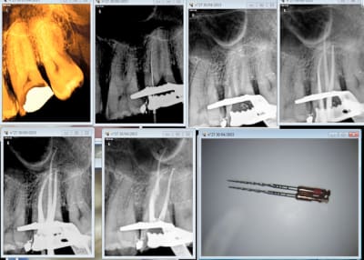 Capture d e cran 2015 04 30 19.01 - Eugenol