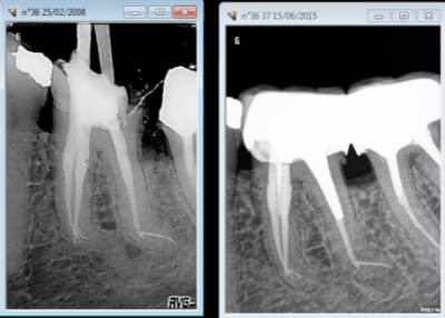 Capture d e cran 2015 06 15 20.51 - Eugenol