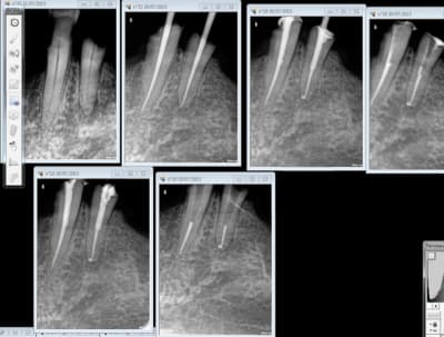 Capture d e cran 2015 07 30 12.41 - Eugenol