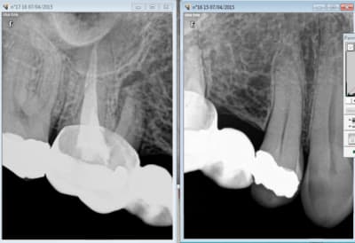 Capture d e cran 2016 04 12 11.40 - Eugenol