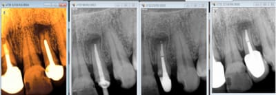 Capture d e cran 2016 04 14 12.07 - Eugenol