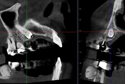 Capture oomdgp - Eugenol