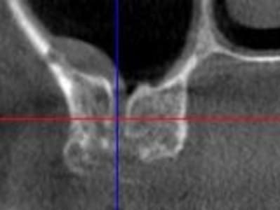 Capture qsaatx - Eugenol