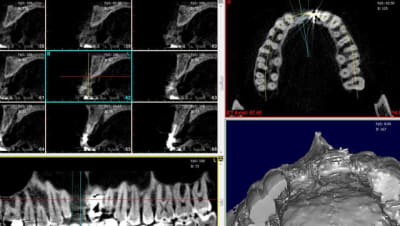 Capture qtyedt - Eugenol