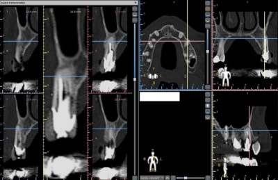 Capture wn3hm5 - Eugenol