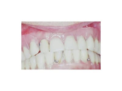 Cas 3 b oaxqad - Eugenol