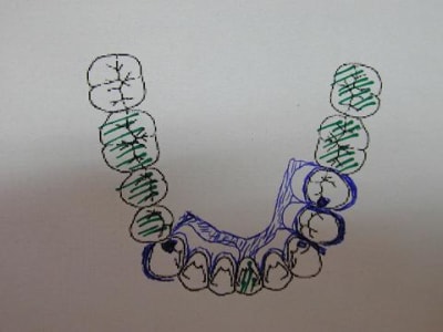 Cas clinique3 lp1xak - Eugenol