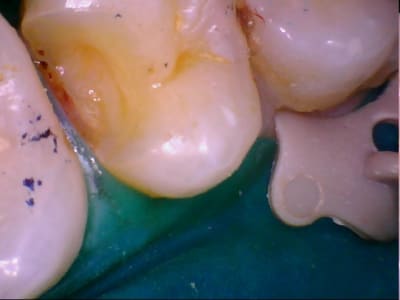 Caval 20120214 15 19 - Eugenol