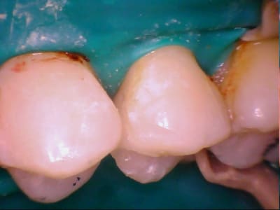 Caval 20120214 4 19 - Eugenol