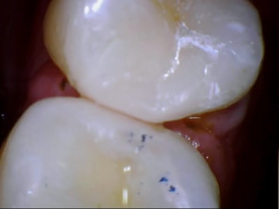 Caval 20120214 8 19 - Eugenol