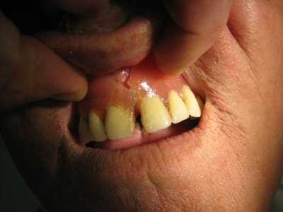 Collage 1 tqob2c - Eugenol