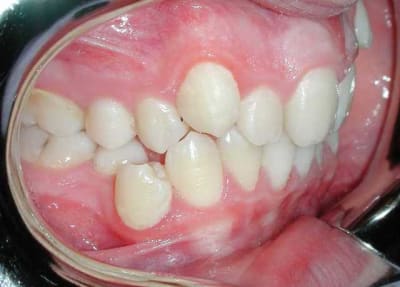 Copie de dscn7793 mmhmu1 - Eugenol
