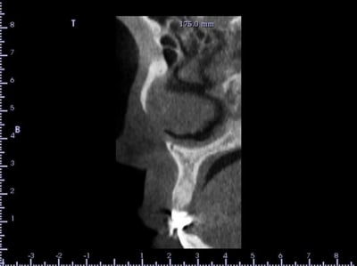 Coupe 2 gssnl9 - Eugenol