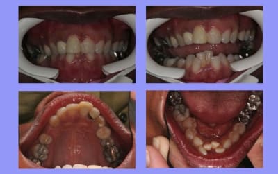 Départ 1 iebtzj - Eugenol