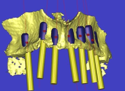 Dar3d7 xgvlbi - Eugenol