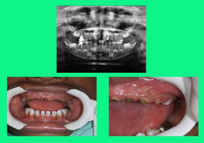 Debut 1 tlipxa - Eugenol