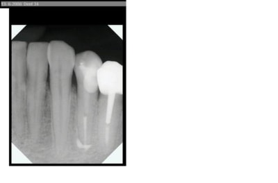 Denia 34 20060613 rgx2qi - Eugenol