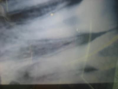 Dents 2 002 z04fml - Eugenol