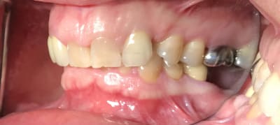 Df1fe9ab 3a6f 489a 8cbc 06fdeedd6b11 tsfg9k - Eugenol