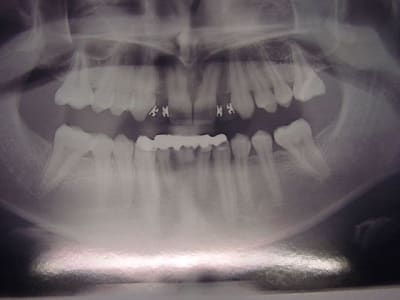 Dsc00091 vo4p11 - Eugenol