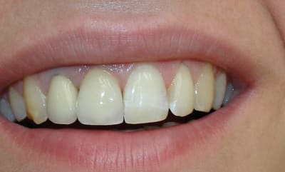 Dsc00379 xqblma - Eugenol