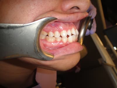 Dsc00860 kluvrd - Eugenol