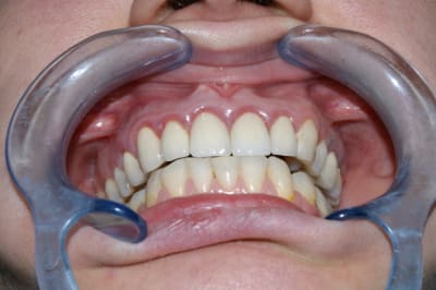 Dsc02700 h1siti - Eugenol