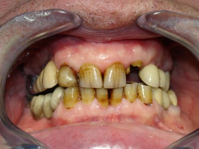 Dsc04312 ckyvs8 - Eugenol