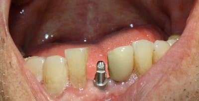 Dsc05189 iewlxh - Eugenol